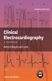 Clinical Electrocardiography: A Textbook, Fourth Edition