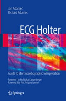 ECG Holter: Guide to Electrocardiographic Interpretation