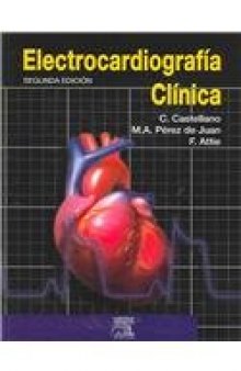 Electrocardiografia Clinica, 2e (Spanish Edition)