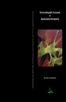 Electrocardiographic assessment of repolarization heterogeneity