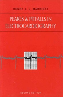Pearls & Pitfalls in Electrocardiography : Pithy, Practical Pointers 2nd Edition