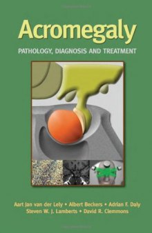Acromegaly: Pathology, Diagnosis and Treatment