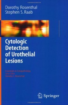 Cytologic Detection of urothelial lesions