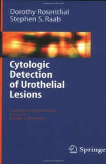 Cytologic Detection of Urothelial Lesions (Essentials in Cytopathology)