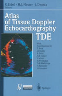 Atlas of Tissue Doppler Echocardiography — TDE