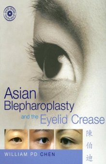 Asian Blepharoplasty and the Eyelid Crease  2nd Edition