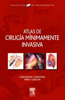 Atlas de Cirugía Mínimamente Invasiva