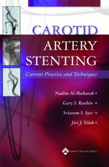 Carotid Artery Stenting: Current Practice and Techniques