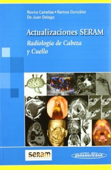Actualizaciones SERAM: Radiologia De Cabeza Y Cuello  