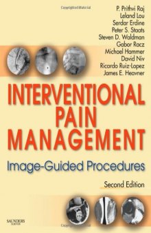 Interventional Pain Management: Image-Guided Procedures, Second Edition  