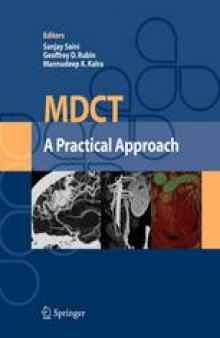 MDCT:A Practical Approach