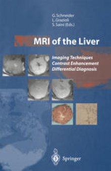 MRI of the Liver: Imaging Techniques Contrast Enhancement Differential Diagnosis