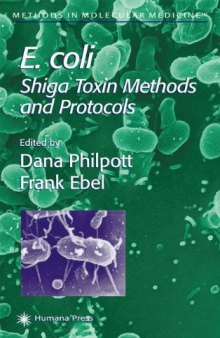 E. coli. Shiga Toxin Methods and Protocols