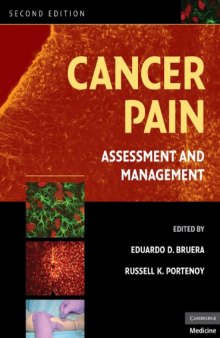 Cancer Pain: Assessment and Management, Second Edition