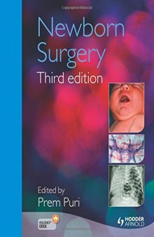 Newborn Surgery 3E
