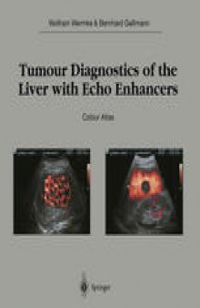 Tumour Diagnostics of the Liver with Echo Enhancers: Colour Atlas