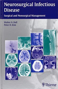 Neurosurgical infectious disease : surgical and nonsurgical management