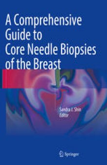 A Comprehensive Guide to Core Needle Biopsies of the Breast