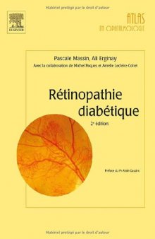 
Rétinopathie Diabétique