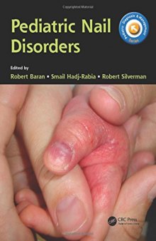 Pediatric nail disorders