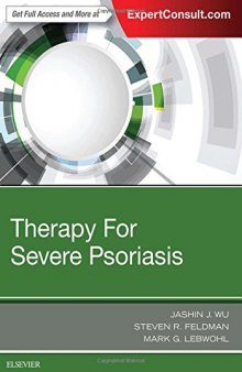 Therapy for Severe Psoriasis