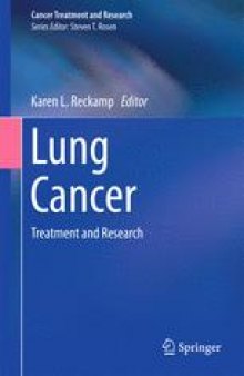 Lung Cancer: Treatment and Research