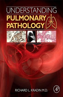 Understanding Pulmonary Pathology. Applying Pathological Findings in Therapeutic Decision Making