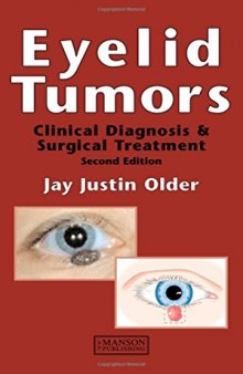 Eyelid Tumours: Clinical Diagnosis and Surgical Treatment