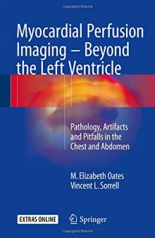 Myocardial Perfusion Imaging - Beyond the Left Ventricle: Pathology, Artifacts and Pitfalls in the Chest and Abdomen