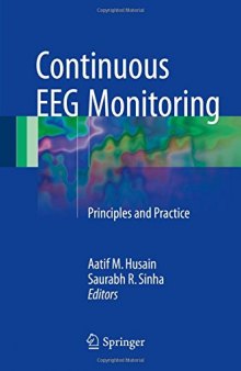 Continuous EEG Monitoring: Principles and Practice