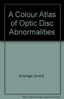A Colour Atlas of Optic Disc Abnormalities