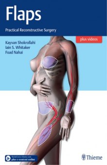 Flaps : practical reconstructive surgery