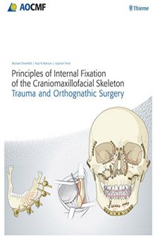 Principles of Internal Fixation of the Craniomaxillofacial Skeleton: Trauma and Othognathic Surgery