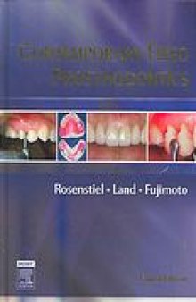 Contemporary fixed prosthodontics