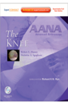 AANA Advanced Arthroscopy. The Knee