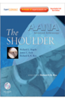AANA Advanced Arthroscopy. The Shoulder
