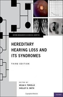Hereditary hearing loss and its syndromes