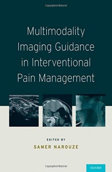 Multimodality imaging guidance in interventional pain management