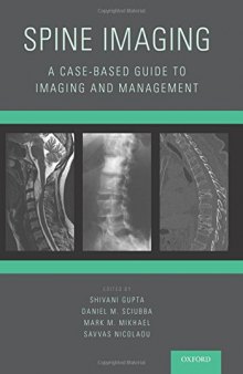 Spine imaging : a case-based guide to imaging and management