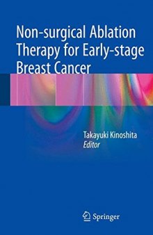 Non-surgical Ablation Therapy for Early-stage Breast Cancer