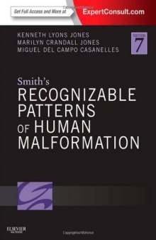 Smith’s Recognizable Patterns of Human Malformation