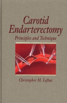 Carotid endarterectomy : principles and technique
