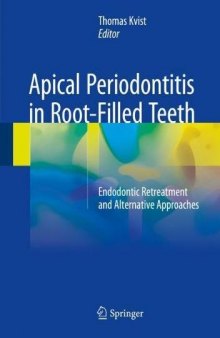  Apical Periodontitis in Root-Filled Teeth: Endodontic Retreatment and Alternative Approaches