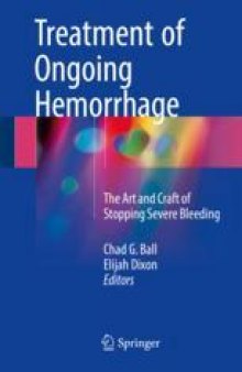 Treatment of Ongoing Hemorrhage: The Art and Craft of Stopping Severe Bleeding