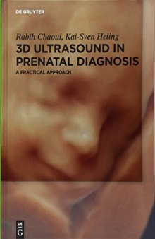 3D Ultrasound in Prenatal Diagnosis: A Practical Approach
