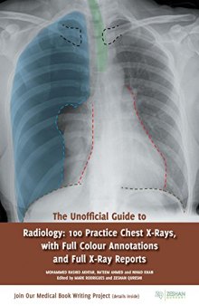 The Unofficial Guide to Radiology