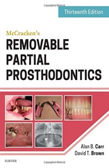 McCracken’s Removable Partial Prosthodontics, 13e