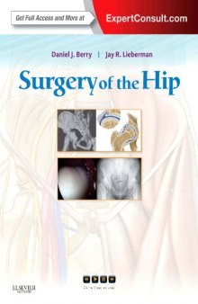 Surgery of the Hip: Expert Consult