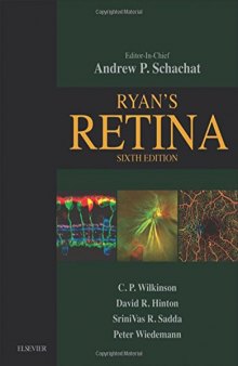 Ryan’s Retina