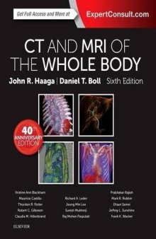 CT and MRI of the Whole Body, 2-Volume Set, 6e, Volume I